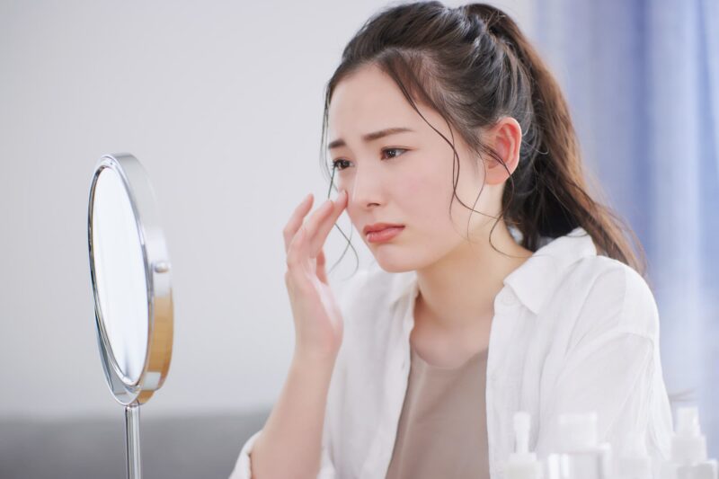 シミでお困りの方へ